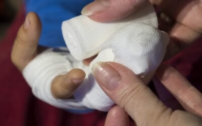 Primeros auxilios en incendios: Guía esencial ante quemaduras e inhalación de humo en entornos laborales y hasta en tu hogar